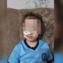 #укус #собака #Яранск. Прокуратура Яранского района через суд взыскала денежную компенсацию в пользу 7-летнего ребенка, получившего травмы из-за укуса собаки