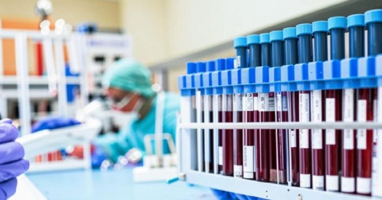 В Кировской области спасли пациента с уникальной кровью