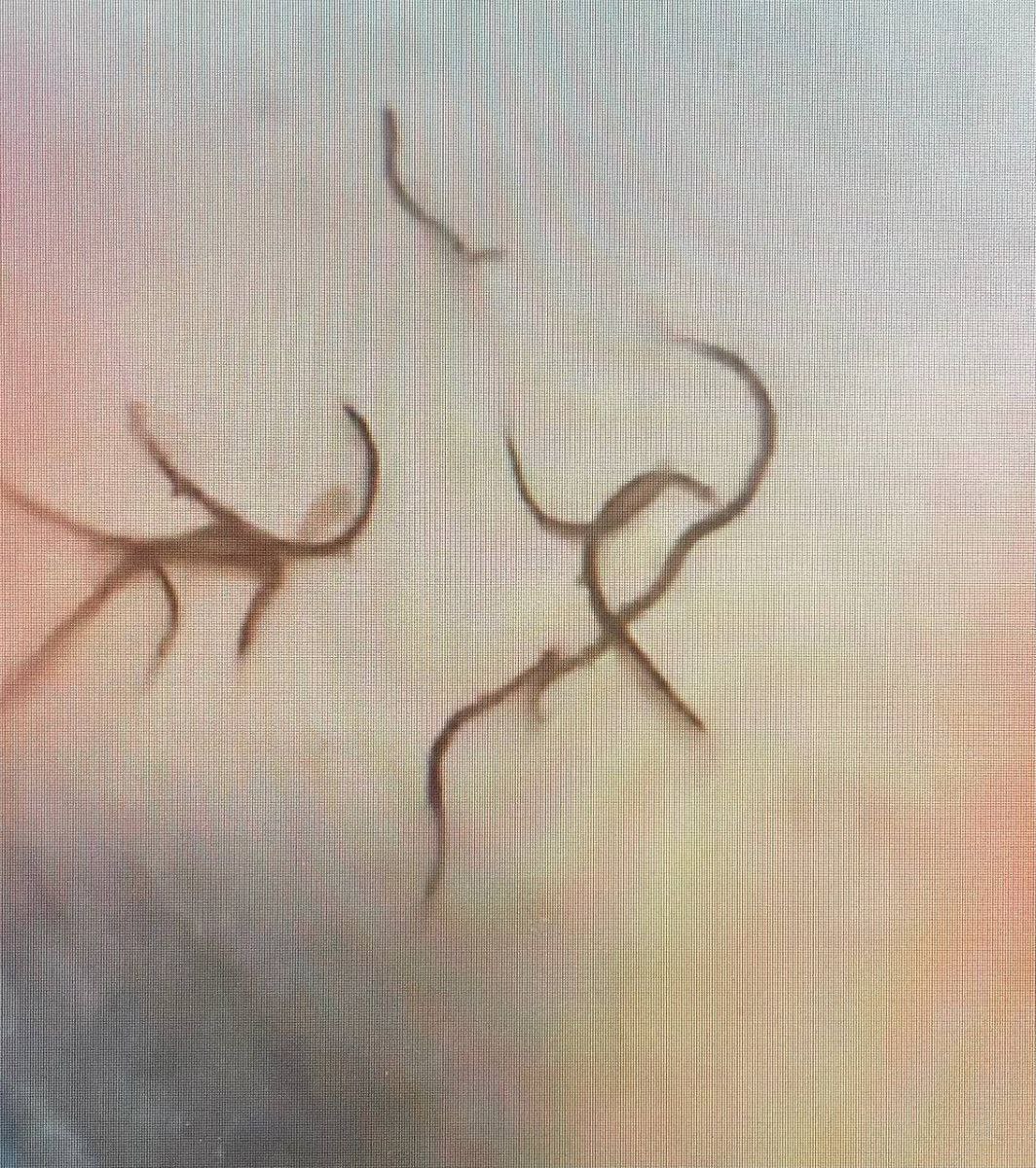 Жители посёлка Безбожник Мурашинского района обратились Народный фронт с жалобой на качество водопроводный воды