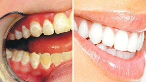 ����������� ������� ������ � ������ �������