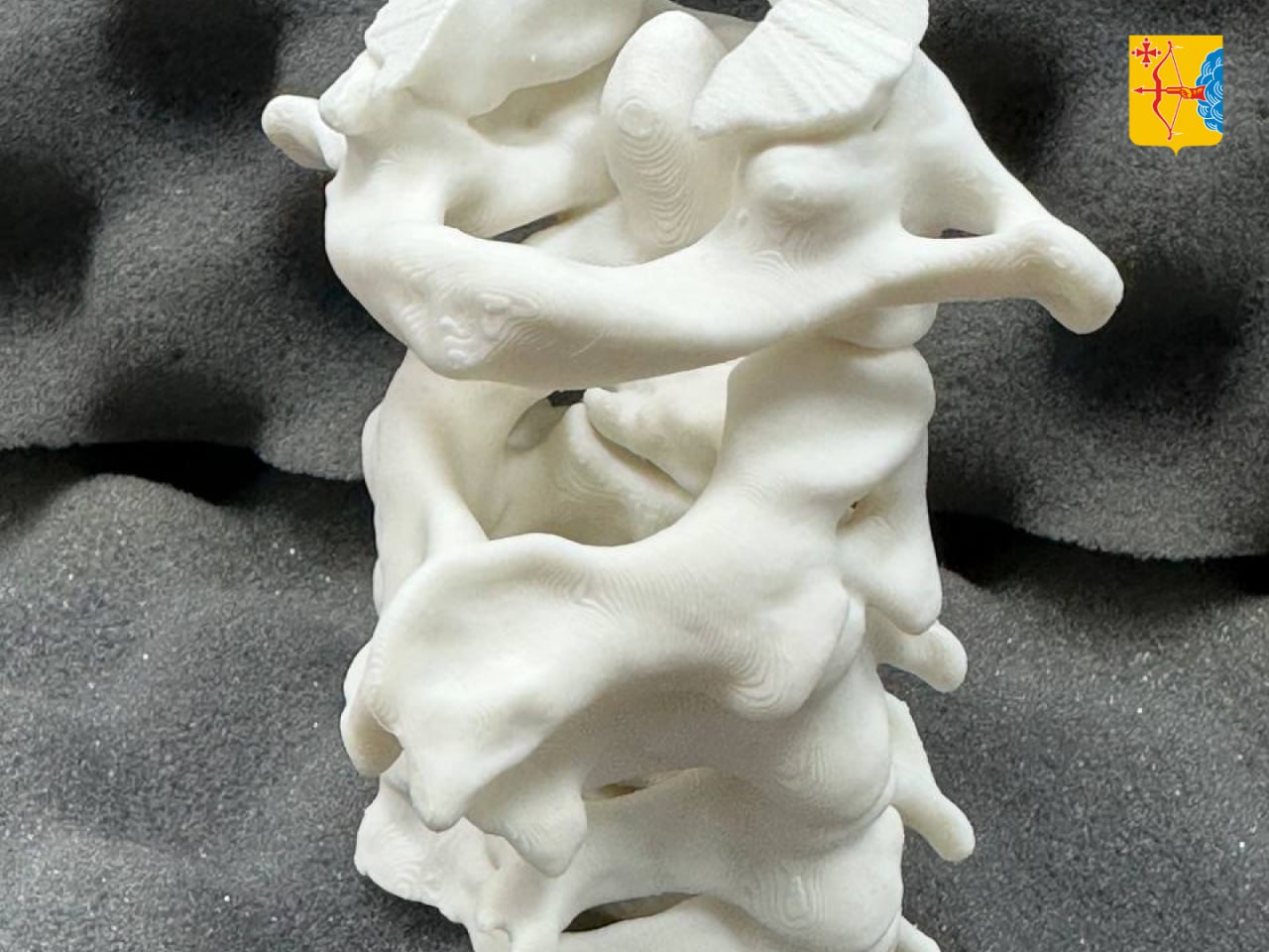 Кировские нейрохирурги помогли мужчине с редким повреждением позвоночника Кировские нейрохирурги помогли мужчине с редким повреждением позвоночника