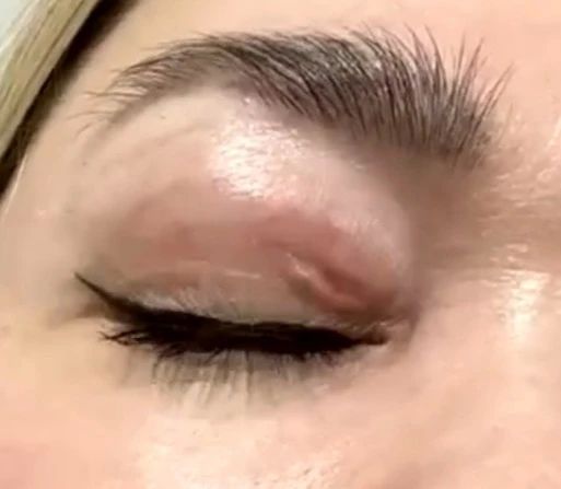 � ������ ����� ������� �� ���� ������� ������� 3- �������������� �����